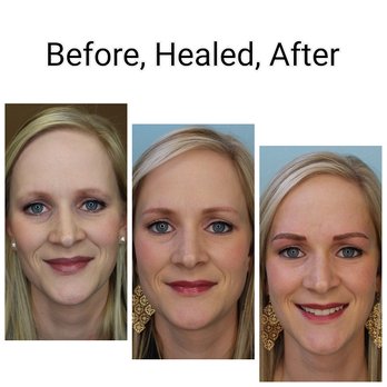 Permanent Makeup by Shannon - Before and After Microblading - Permanent Makeup Near Me - Robbinsdale, Minnesota Permanent Makeup by Shannon - Before and After Microblading - Permanent Makeup Near Me - Robbinsdale, Minnesota