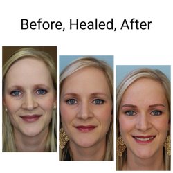 Permanent Makeup by Shannon - Before and After Microblading