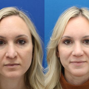 Christian Paquet, MD - Cosmetic Surgeons Near Me - Phoenix, Arizona Christian Paquet, MD - Cosmetic Surgeons Near Me - Phoenix, Arizona