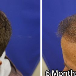 Advanced Medical Hair Institute