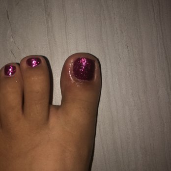 Blossom Nails & Spa - Swollen /infected toe morning after pedicure - Nail Salons Near Me - Hollister, California Blossom Nails & Spa - Swollen /infected toe morning after pedicure - Nail Salons Near Me - Hollister, California