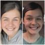 Smile Doctors by DN Ortho - Hammond