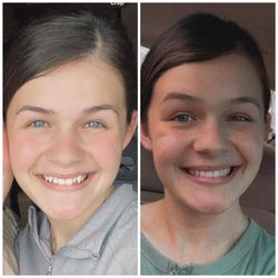 Smile Doctors by DN Ortho - Hammond