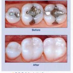 Laura Miller, DDS - Same Day Crowns done while you wait!!!