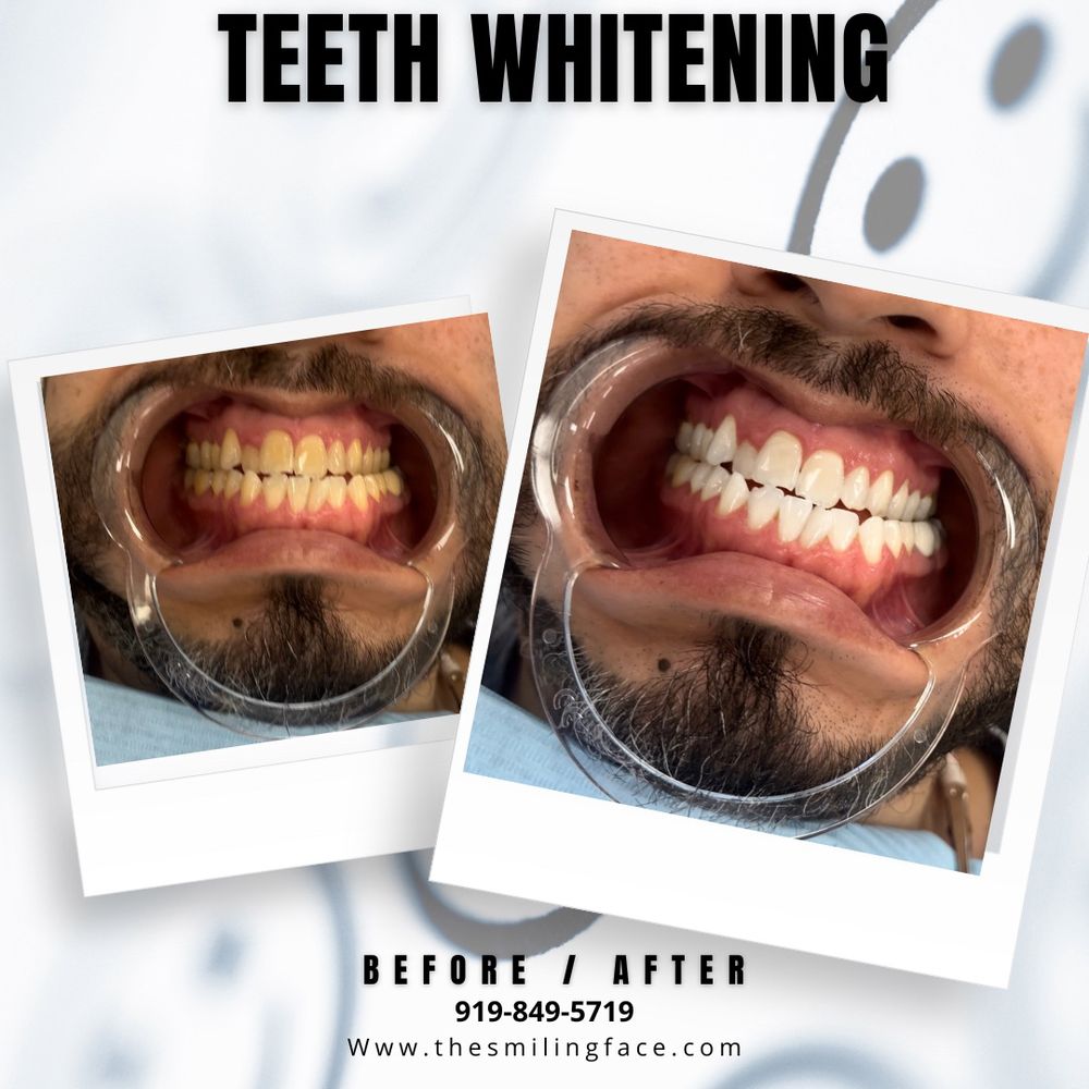 THE SMILING FACE 35 Photos 7277 Hwy 42 W, Raleigh, North Carolina