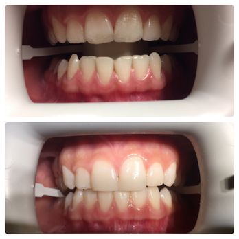 Bella Mnatsakanyan, DDS - Cosmetic Dentists Near Me - Glendale, California