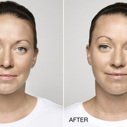 Total Hair and Body Medical - For expert Botox and Dysport treatments in Knoxville, turn to us for a natural, youthful look. We'll find the right combination of treatment