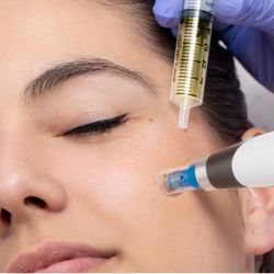 New Skin by Lynn - Microneedling by RN under sterile technique FDA approved devices & Clinically proven solutions. Great for acne, scars, wrinkles, dark spots