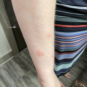 Big Cypress Lodge - More bed bug bites - Hotels Near Me - Memphis, Tennessee Big Cypress Lodge - More bed bug bites - Hotels Near Me - Memphis, Tennessee