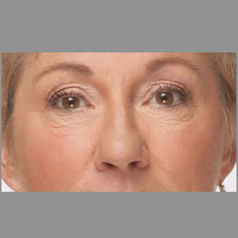 Refine Cosmetic Clinic - Medical Spas Near Me - Toronto, Ontario Refine Cosmetic Clinic - Medical Spas Near Me - Toronto, Ontario