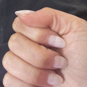 Daily Nails & Spa - Hideous "ombré" from other nail salon. Not Daily Nails. Not blended. Not shaped - Nail Salons Near Me - Springfield, Virginia