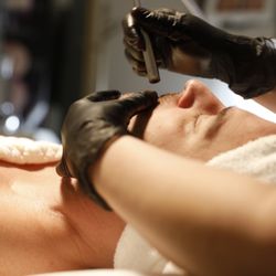 Renova Aesthetics - Microderm Abrasion