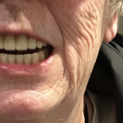 Bellingham Denture Clinic