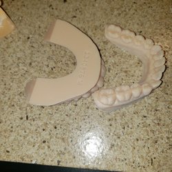 You really can see all imperfections of your teeth in cast