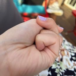 Chipped nail