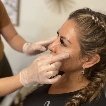 BB Beauty Lounge - Cheek filler - Medical Spas Near Me - Tucson, Arizona