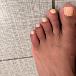 Sloppy pedicure
