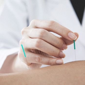 Scottsdale Integrative Acupuncture - Skilled Acupuncture - Acupuncture Near Me - Phoenix, Arizona Scottsdale Integrative Acupuncture - Skilled Acupuncture - Acupuncture Near Me - Phoenix, Arizona