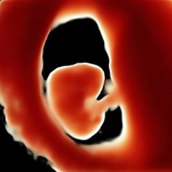 Advanced Sonograms of Alaska - 3D sonogram of 7 week fetus