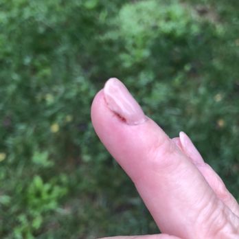 Fancy Nails & Spa - Nailbed trauma from manicure - Nail Salons Near Me - Purcellville, Virginia Fancy Nails & Spa - Nailbed trauma from manicure - Nail Salons Near Me - Purcellville, Virginia