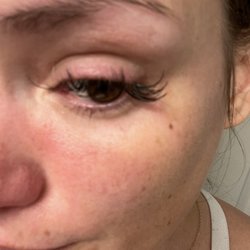 Dep Lashes - Frisco - Swollen eyelid,
