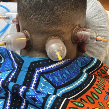 Hijama Cupping Therapy - Head Hijama for headaches, migraines memory loss etc - Massage Therapy Near Me Hijama Cupping Therapy - Head Hijama for headaches, migraines memory loss etc - Massage Therapy Near Me