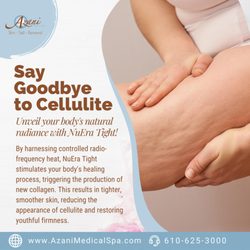 Azani Medical Spa - Get Ready to Say Goodbye to Cellulite!
Attention, residents of Bethlehem and Allentown! We have an exciting announcement for you! In