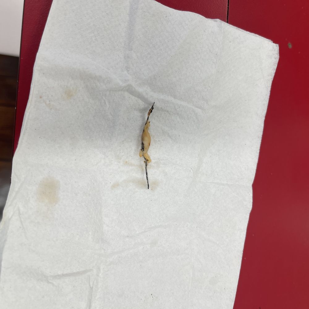 This the wire that was in my child's pizza that she was chewing