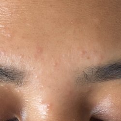 iBrowBar - Small red bumps where wax was placed. 2 days after service.
