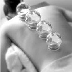 Sunshine State Acupuncture - Sunshine State Acupuncture in Orlando: offers Cupping therapy. To book cupping with Sunshine State Acupuncture: (407)681-2300.Open daily.