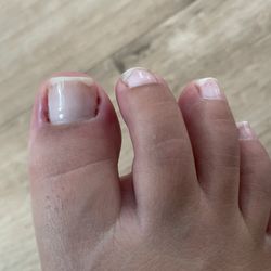 Nail Tech & Spa - This photo was taken right after I left the nail salon. My toe was throbbing with pain.