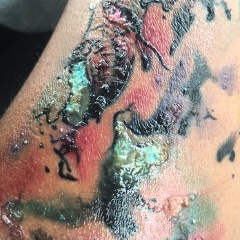 Black Omen Tattoo - Infected 2 days into it, looks like shit. - Tattoo Near Me - Las Vegas, Nevada Black Omen Tattoo - Infected 2 days into it, looks like shit. - Tattoo Near Me - Las Vegas, Nevada