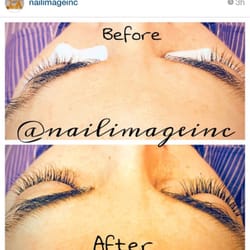 Nail Image