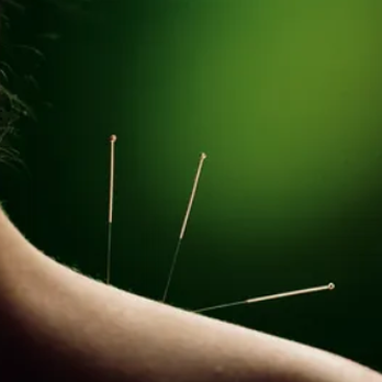 Discover Balance - Acupuncture Near Me - Vancouver, Washington Discover Balance - Acupuncture Near Me - Vancouver, Washington
