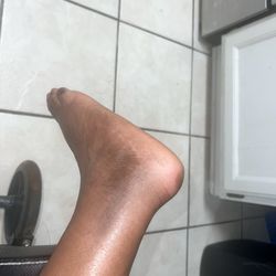 Campbell Clinic Orthopaedics - Wolf River - Ankle post cast