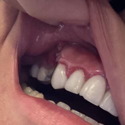 Georgetown 3D Dental - My gum got infection really bad.