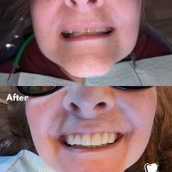 Finn Hill Dental