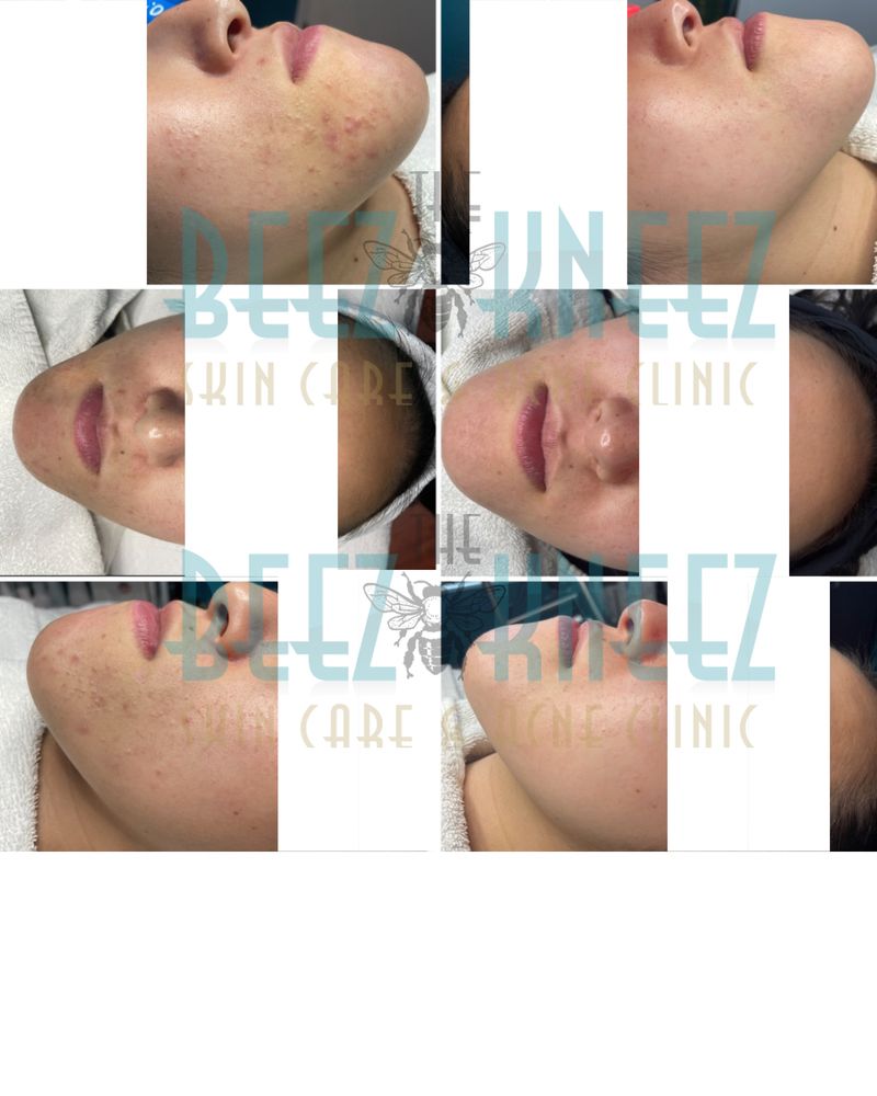 The Beez Kneez Skin Care and Acne Clinic Logo