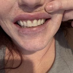 Winlock Family Dentistry - I can't stop smiling. I'm still numb but I'm still smiling.