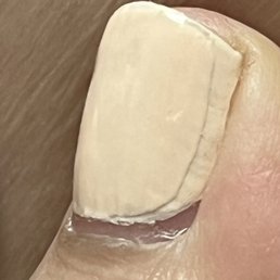 Fresh pedicure. Cuticles and nail bed is a mess and the layering of the polish is horrible. Fresh pedicure. Cuticles and nail bed is a mess and the layering of the polish is horrible.