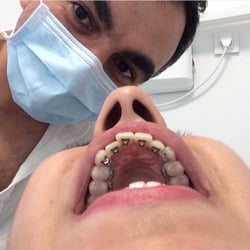 Ortodonti Uzmanı Dr. Ozan Topcu - Lingual Ortodonti İzmir diş teli kliniği.