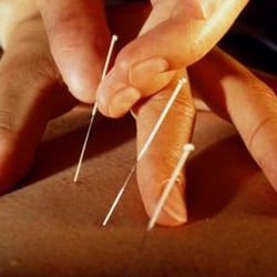 Chen's Holistic Acupuncture