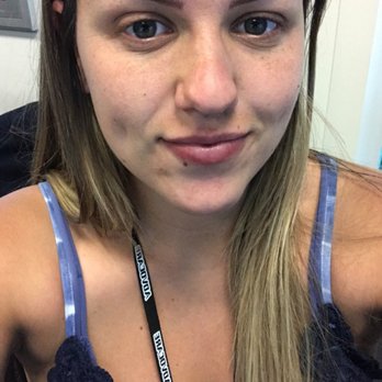 Wink Aesthetics & Spa - After - Permanent Makeup Near Me - Draper, California Wink Aesthetics & Spa - After - Permanent Makeup Near Me - Draper, California