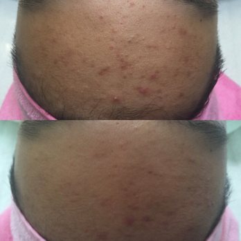 Mikishinki - Skin Care Near Me - Temple City, California