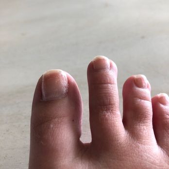 Queen's Nails & Day Spa - Toes and nails were supposed to match. - Hair Salons Near Me - Biloxi, Mississippi Queen's Nails & Day Spa - Toes and nails were supposed to match. - Hair Salons Near Me - Biloxi, Mississippi
