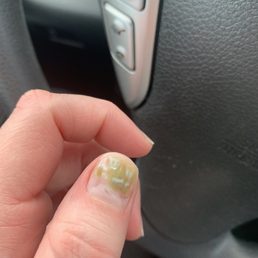 Disgusting nail fungus-their equipment is dirty!!!