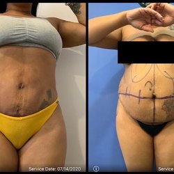 Younger Image Plastic Surgery Center