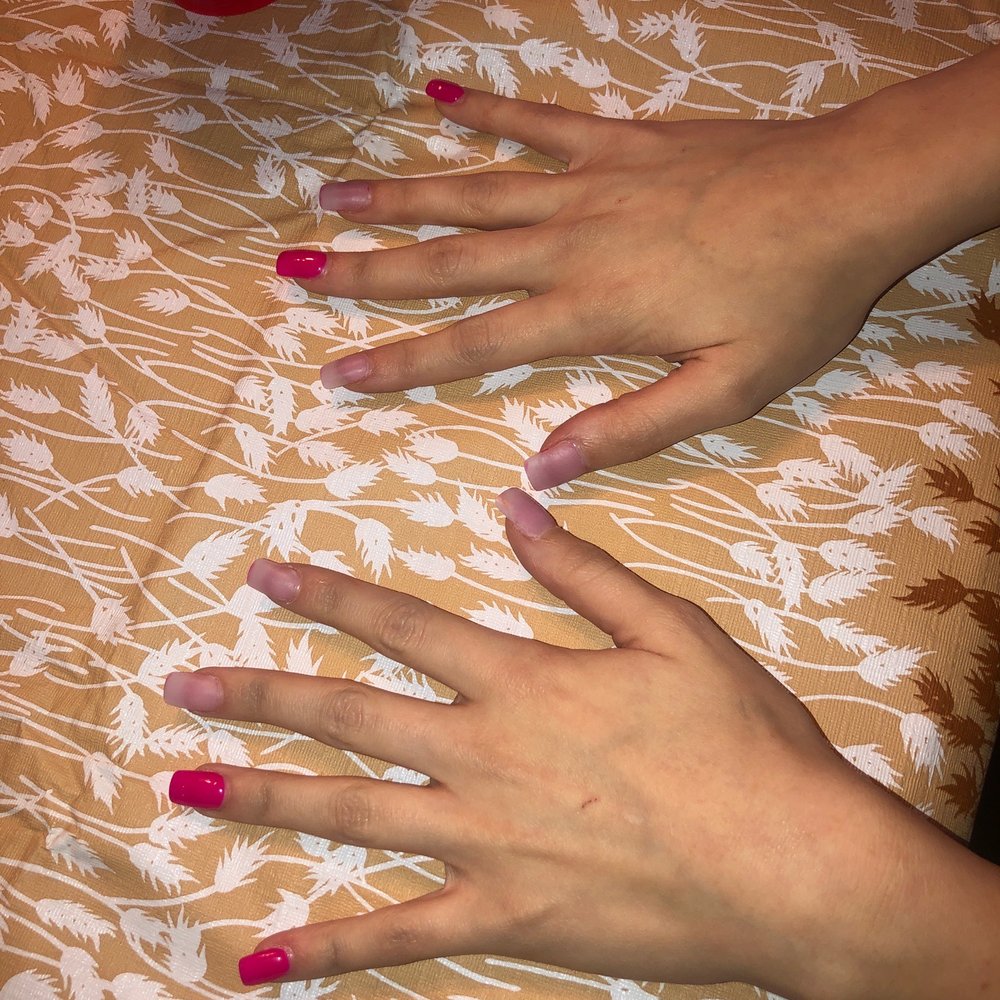 6 nails completely off. Seriously awful.