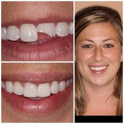 Simply Dental