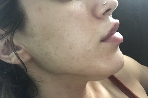 holistic facials near me